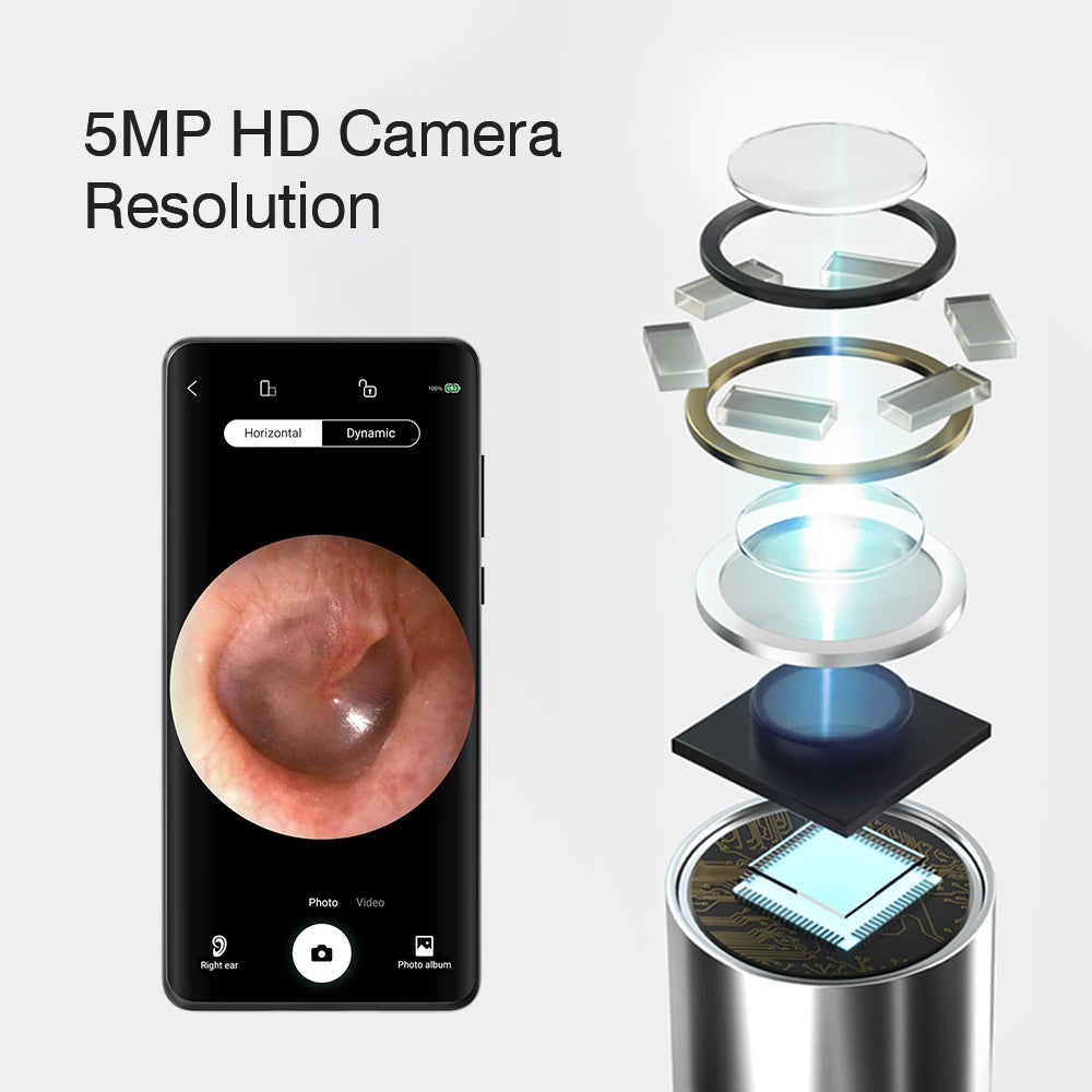ClearEar Pro: otoscopio visual inalámbrico de 5 MP con palillo de silicona seguro