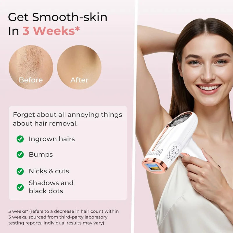 ForeverSmooth IPL Pro – Permanent Hair Removal Made Simple