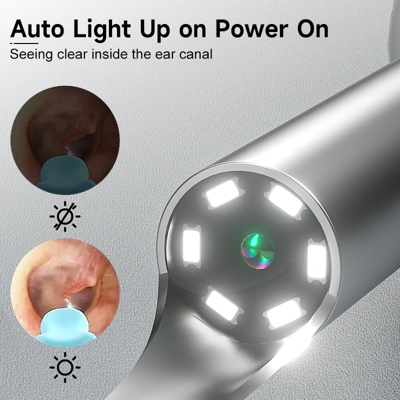 ClearView Ear Pro – WiFi Digital Ear Wax Removal Camera with 6 LEDs
